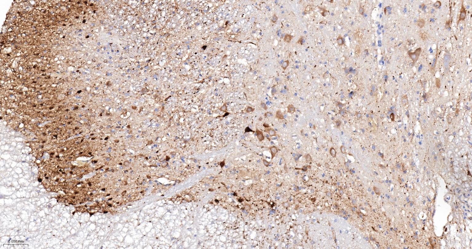 钙结合蛋白D28K重组兔单抗-bsm-60713R