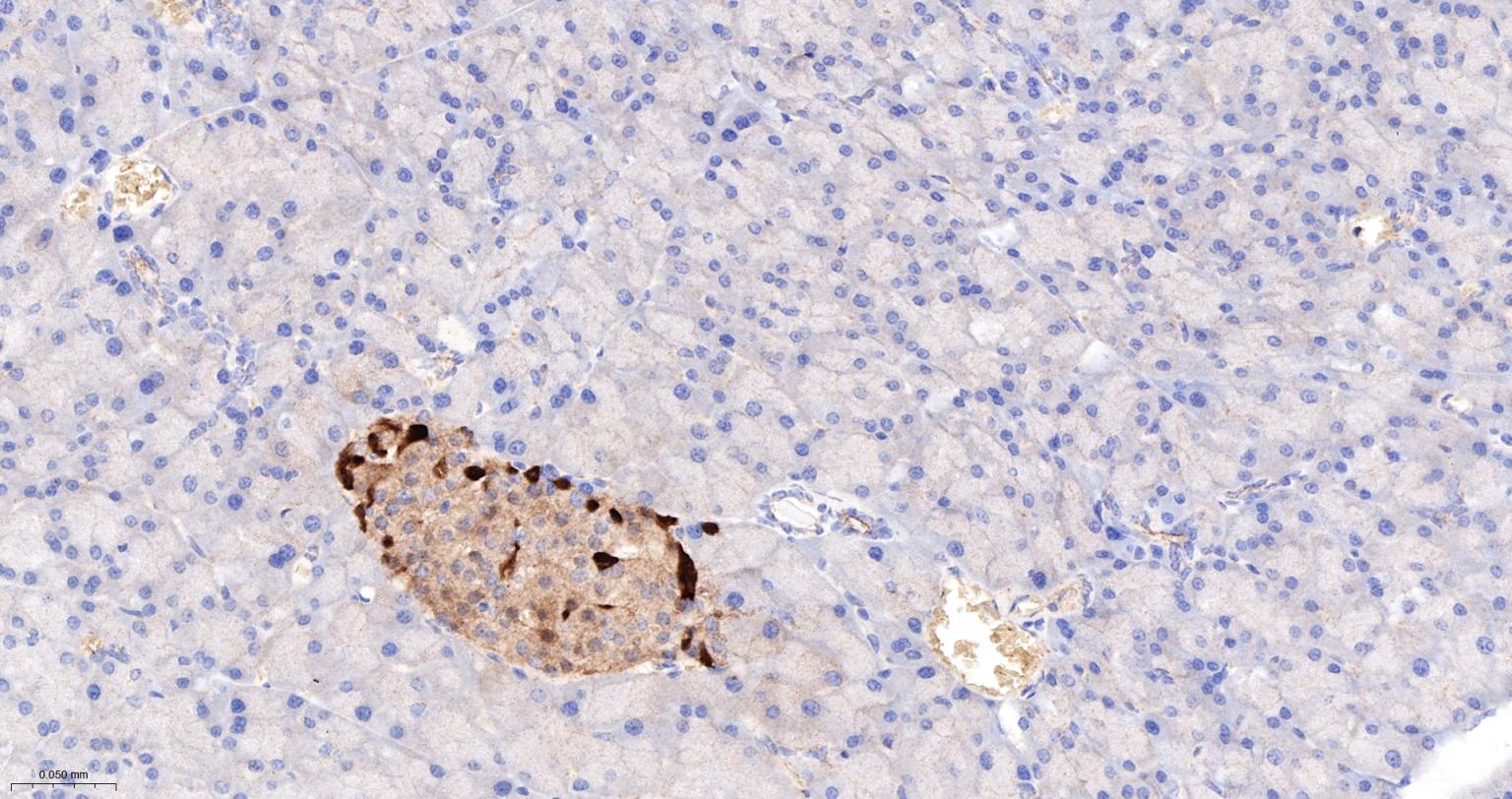 钙结合蛋白D28K重组兔单抗-bsm-60713R