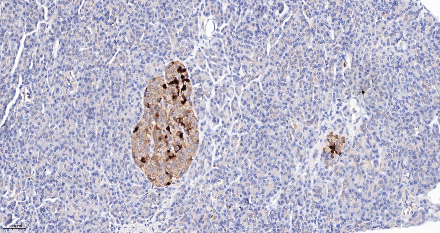 钙结合蛋白D28K重组兔单抗-bsm-60713R