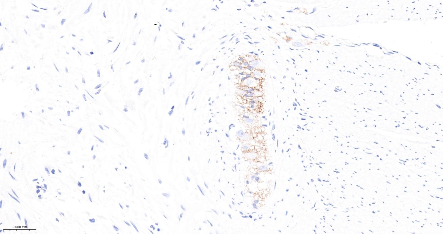 神经细胞粘附分子1重组兔单抗-bsm-52824R