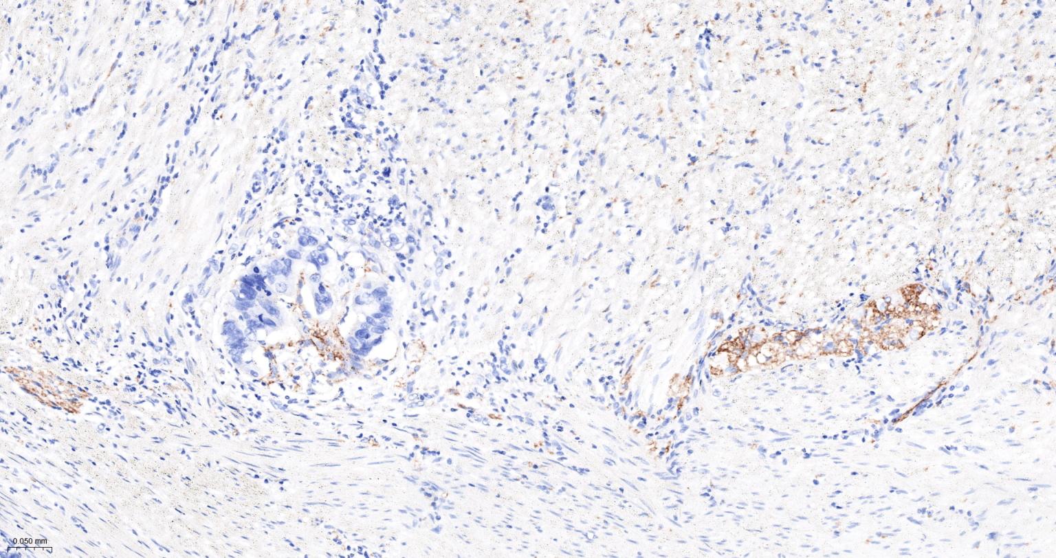 神经细胞粘附分子1重组兔单抗-bsm-52824R
