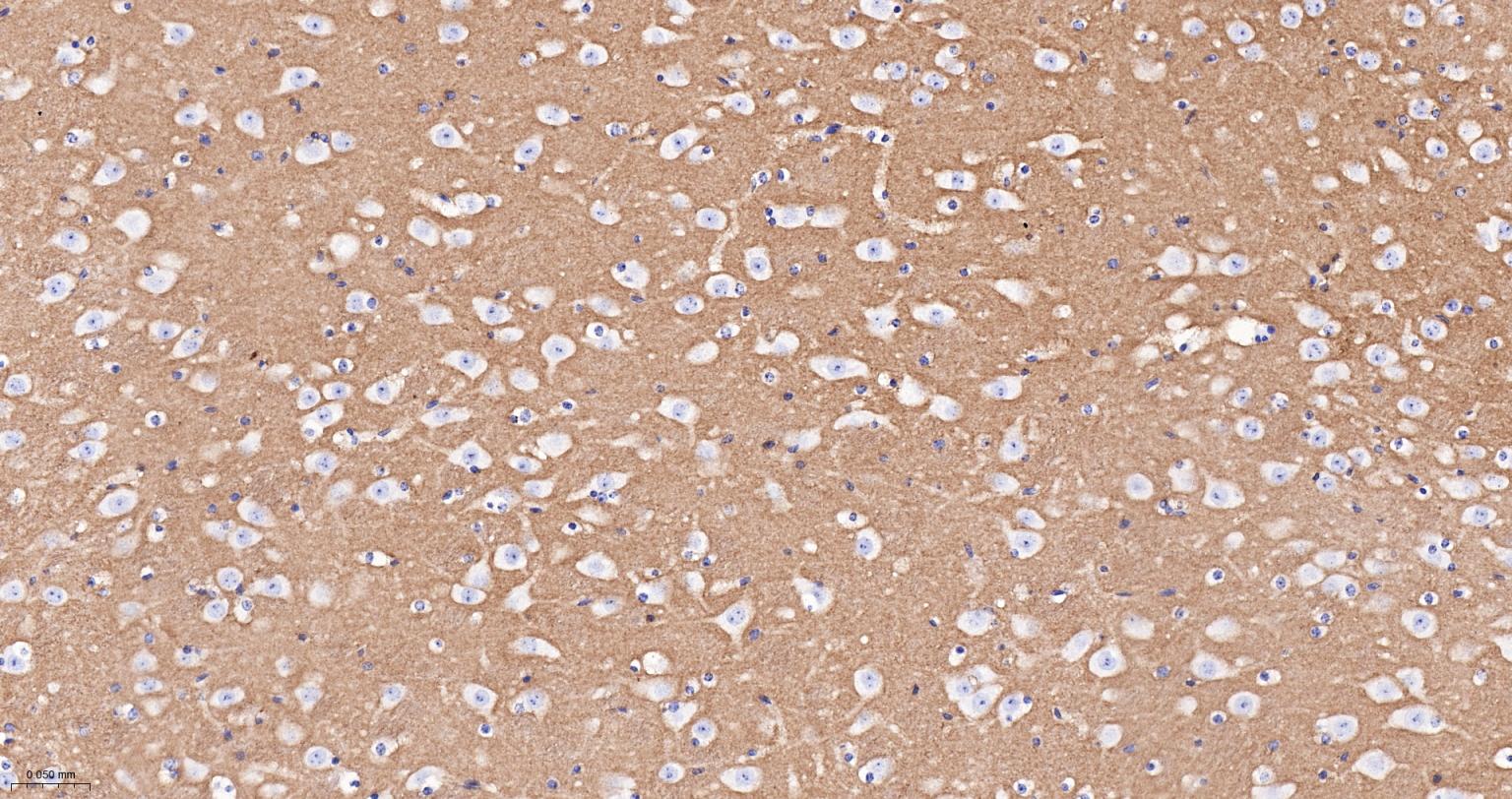 神经细胞粘附分子1重组兔单抗-bsm-52824R