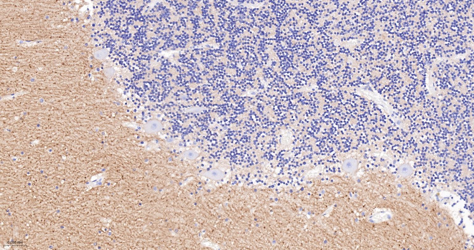 神经细胞粘附分子1重组兔单抗-bsm-52824R