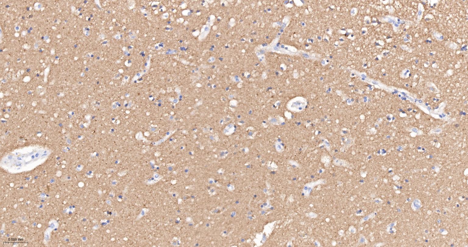 神经细胞粘附分子1重组兔单抗-bsm-52824R