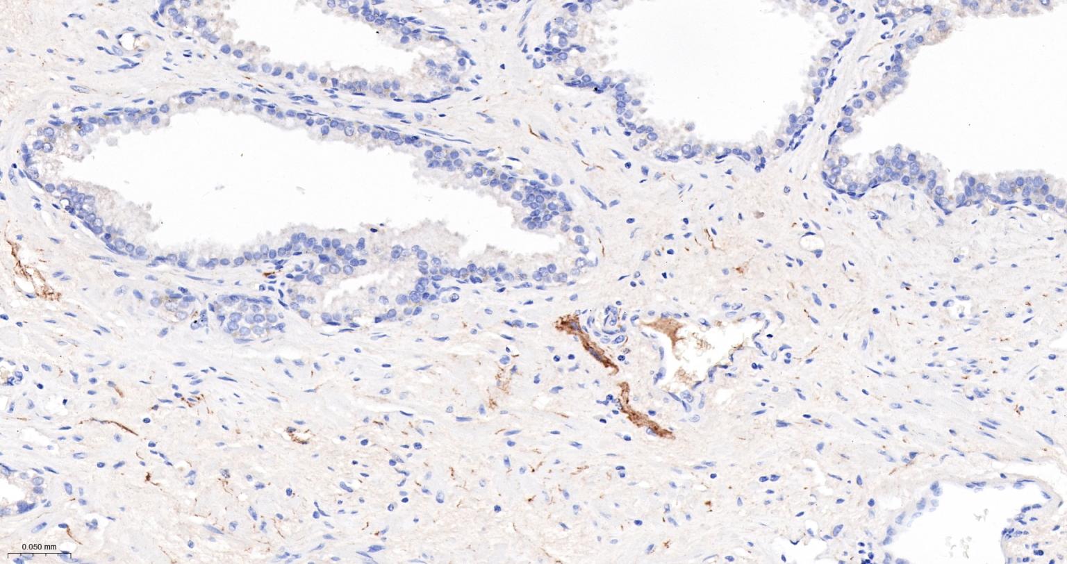 神经细胞粘附分子1重组兔单抗-bsm-52824R