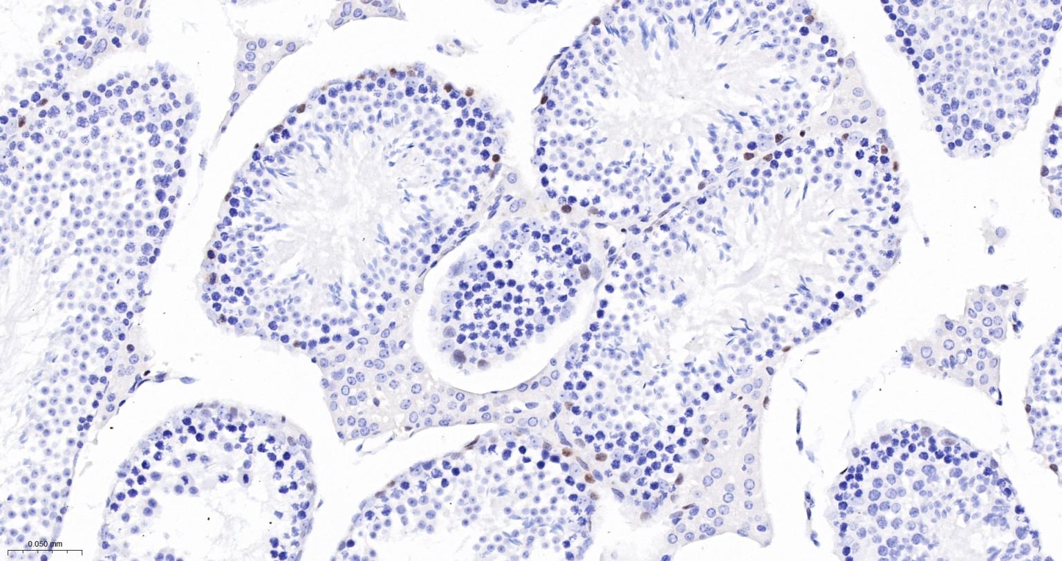 周期素D1重组兔单抗-bsm-52046R