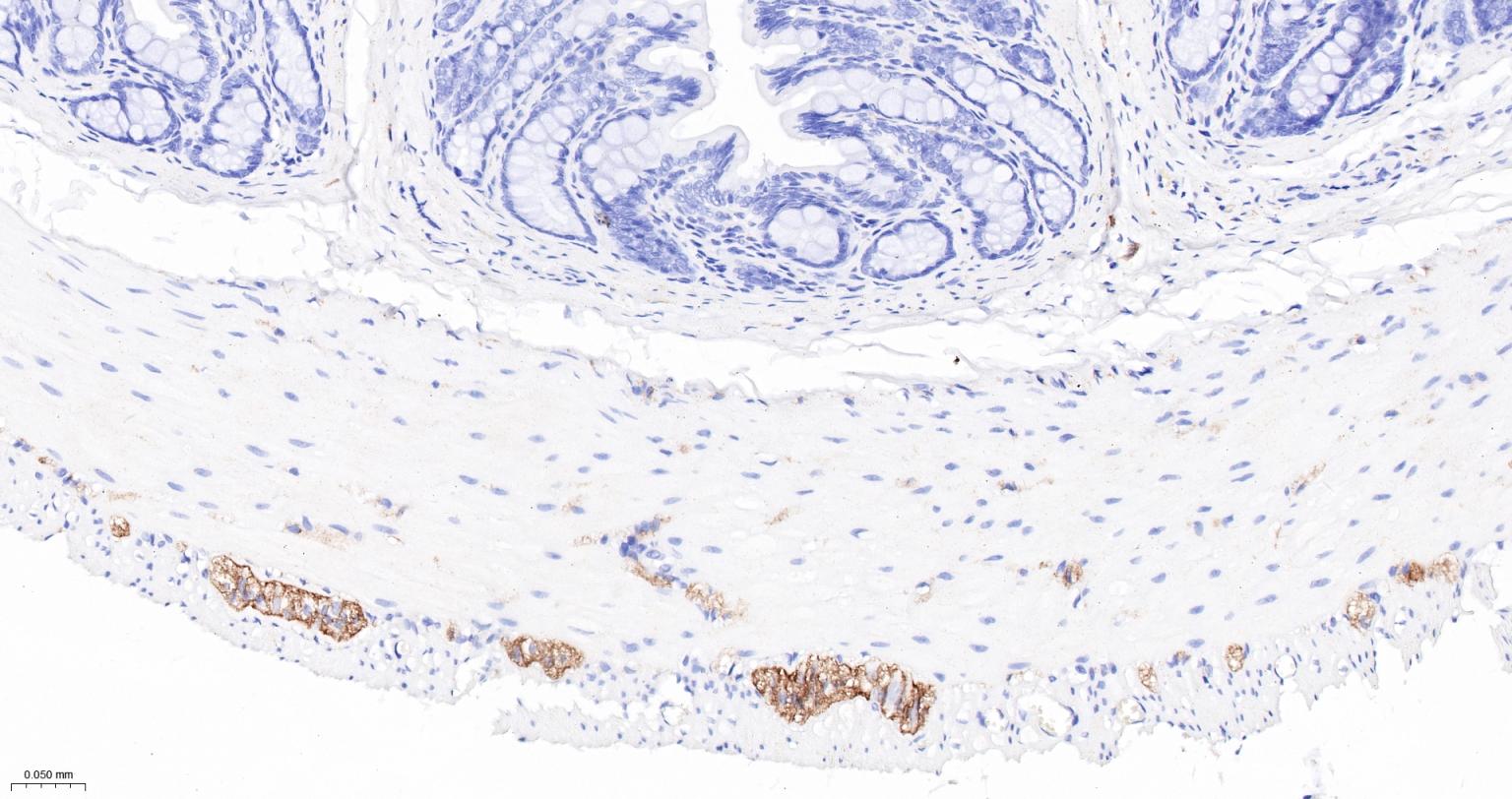 神经细胞粘附分子1重组兔单抗-bsm-52824R