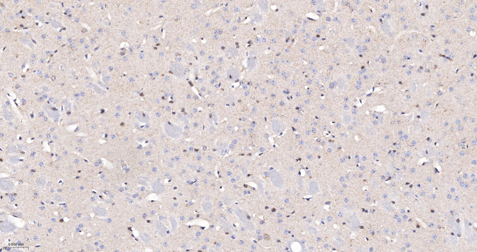 柠檬酸合成酶CISY重组兔单抗-bsm-54190R