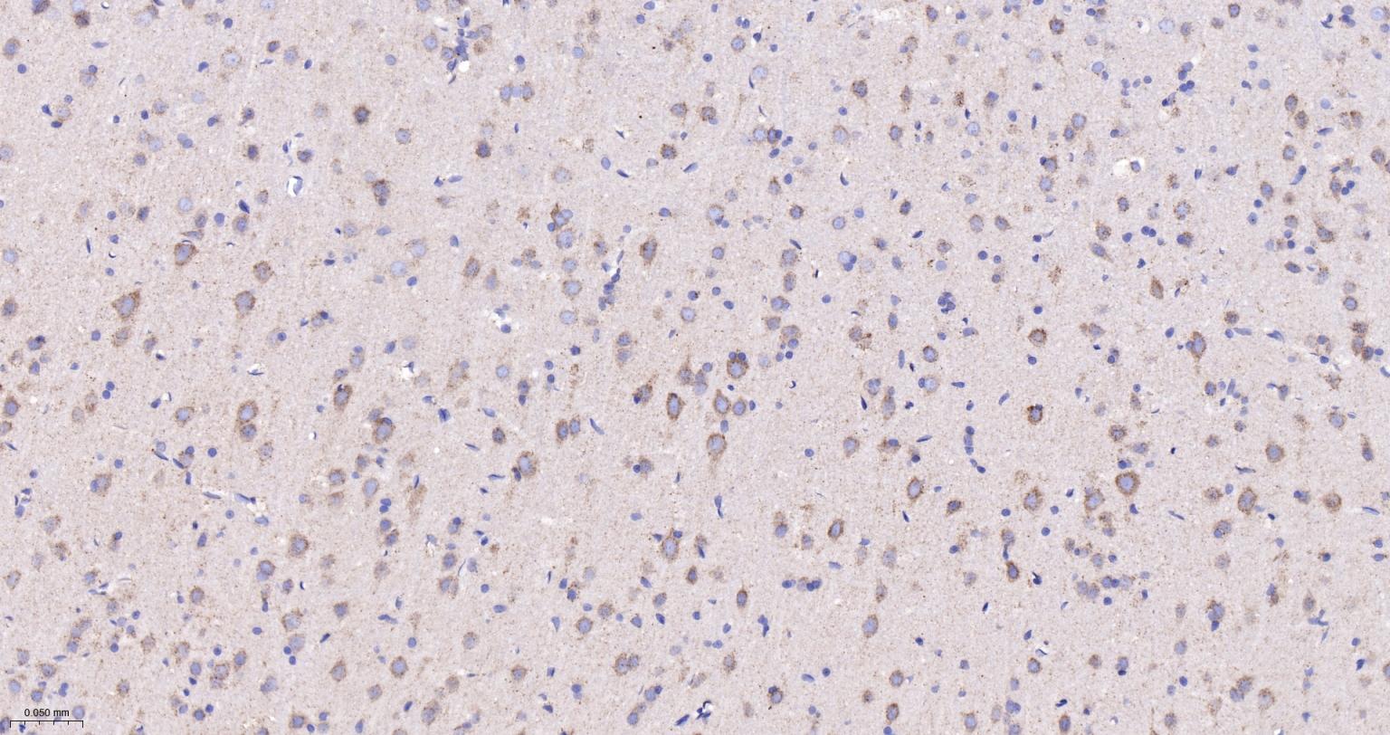 柠檬酸合成酶CISY重组兔单抗-bsm-54190R