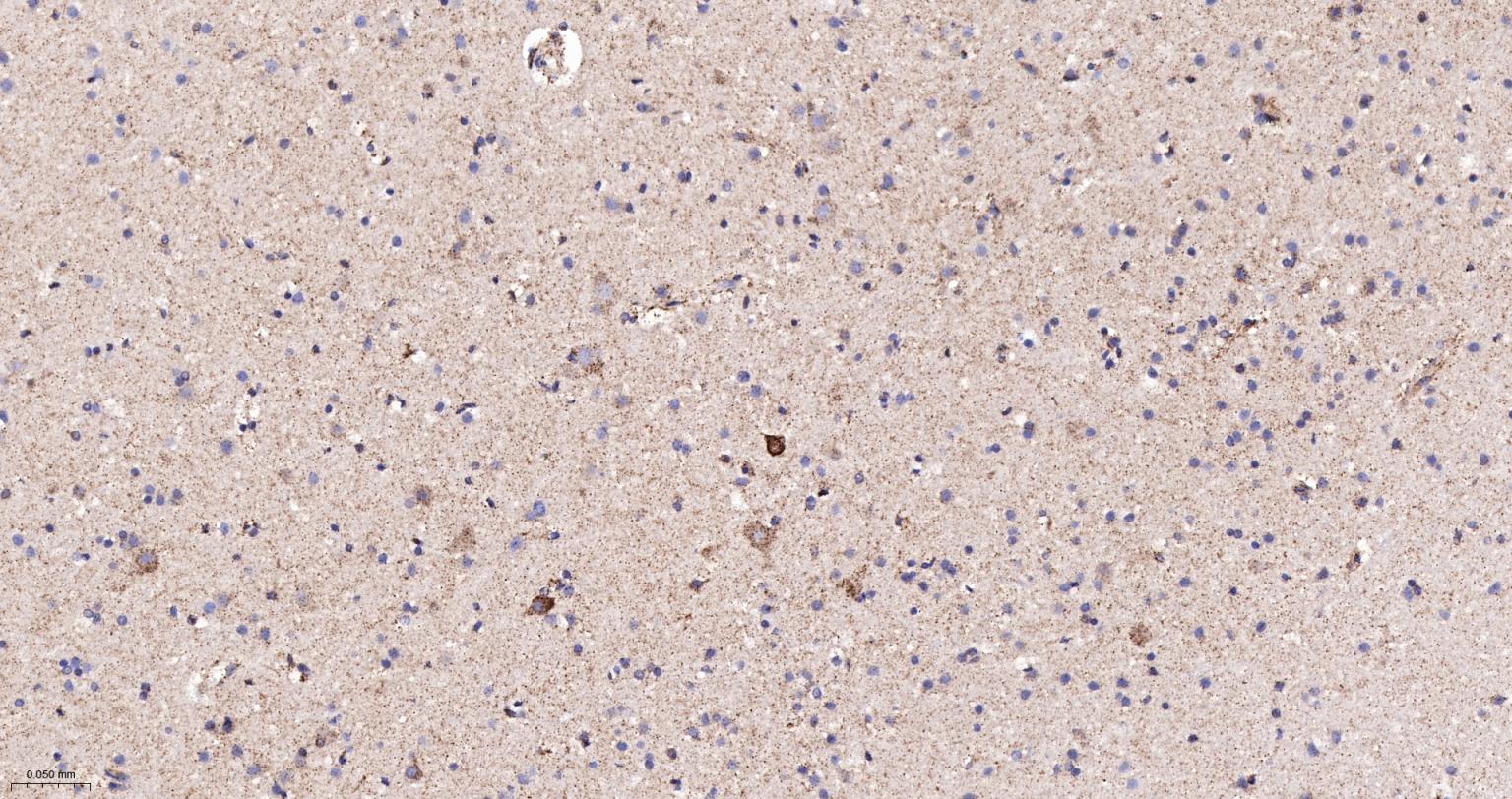 柠檬酸合成酶CISY重组兔单抗-bsm-54190R