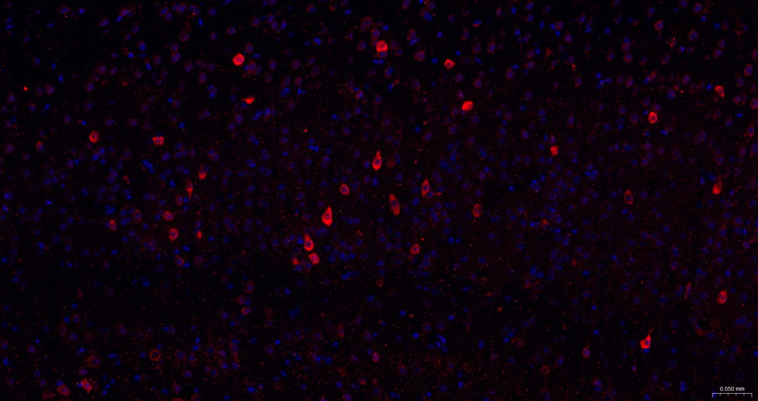 神经生长因子β重组兔单抗-bsm-52362R
