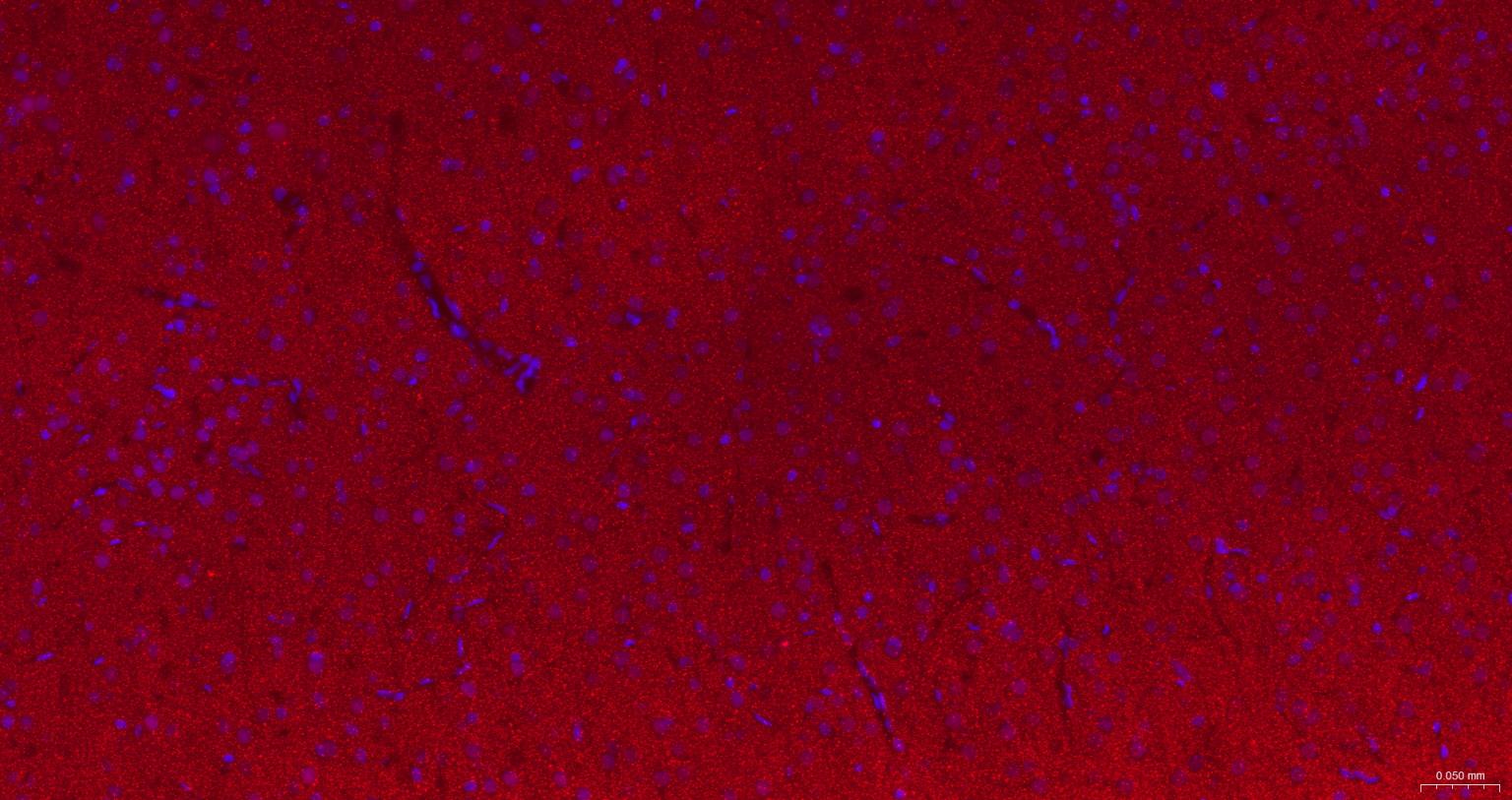 核突触蛋白-α重组兔单抗-bsm-54277R