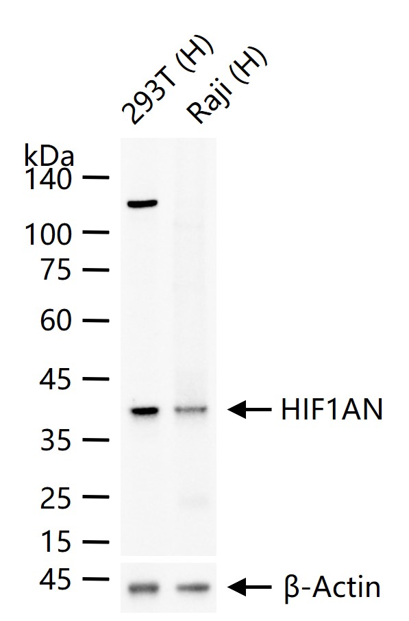 缺氧诱导因子1α抑制蛋白/HIF1AN重组兔单抗-bsm-61905R