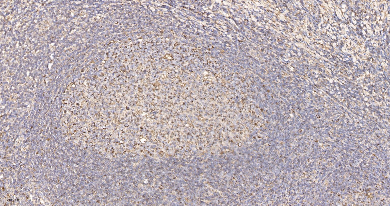 人IgM重组兔单抗-bsm-52860R