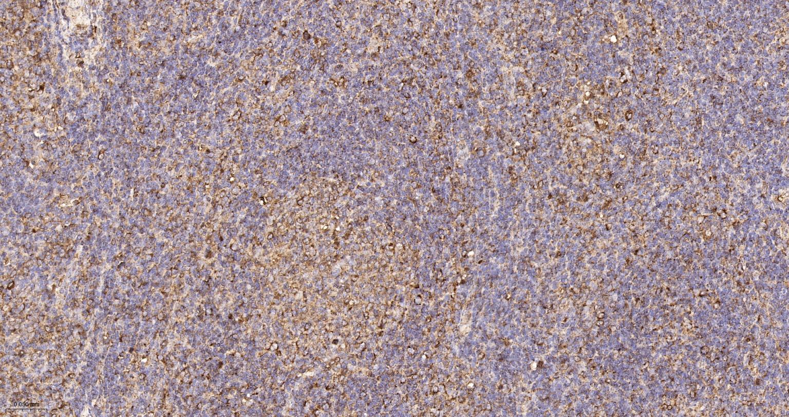 人IgM重组兔单抗-bsm-52860R