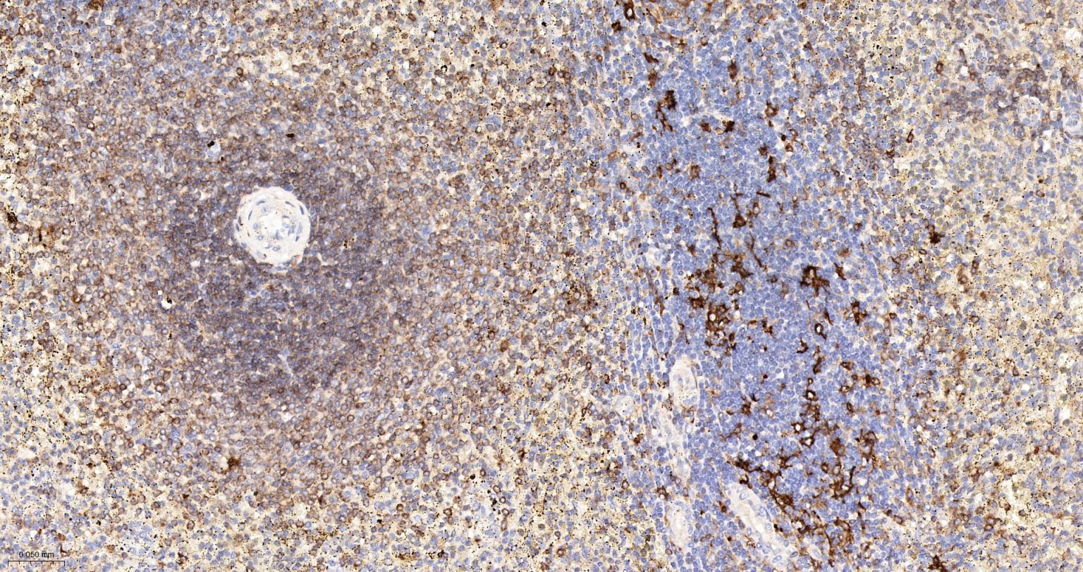 人IgM重组兔单抗-bsm-52860R