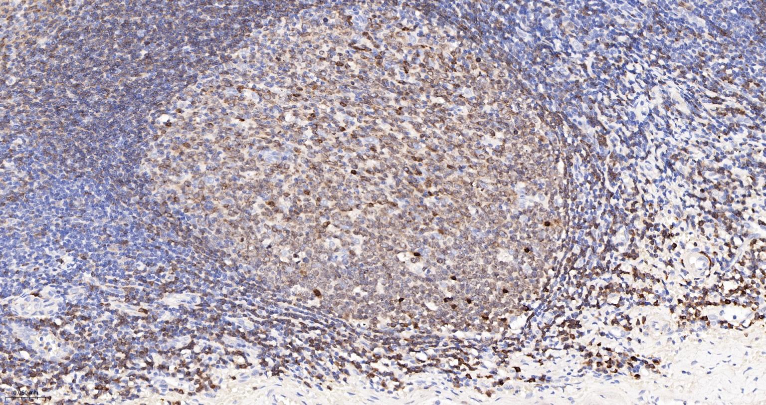 CD79A重组兔单克隆抗体-bsm-60791R