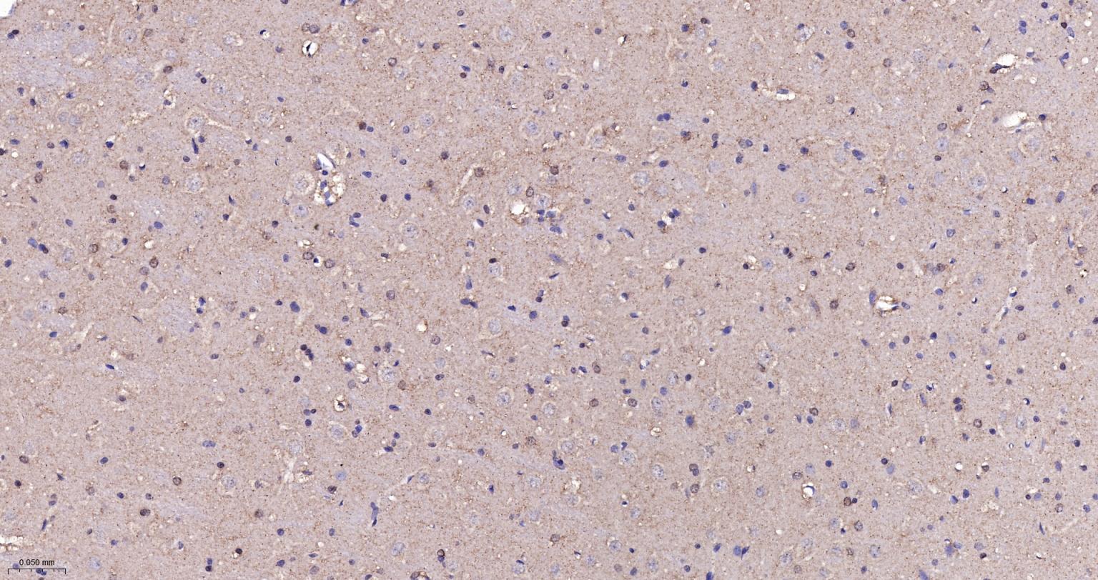老年痴呆相关类钙粘蛋白CS1重组兔单抗-bsm-62063R
