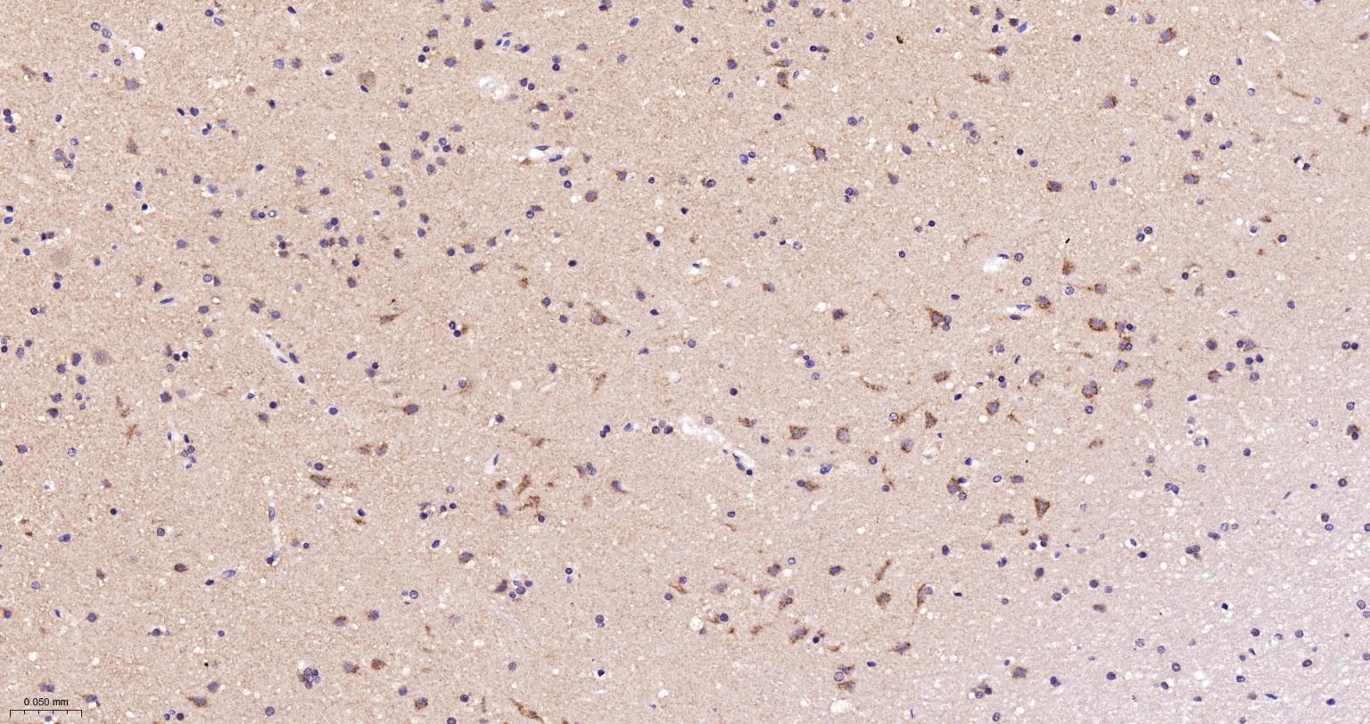 老年痴呆相关类钙粘蛋白CS1重组兔单抗-bsm-62063R