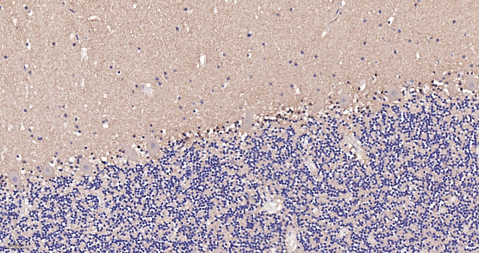老年痴呆相关类钙粘蛋白CS1重组兔单抗-bsm-62063R