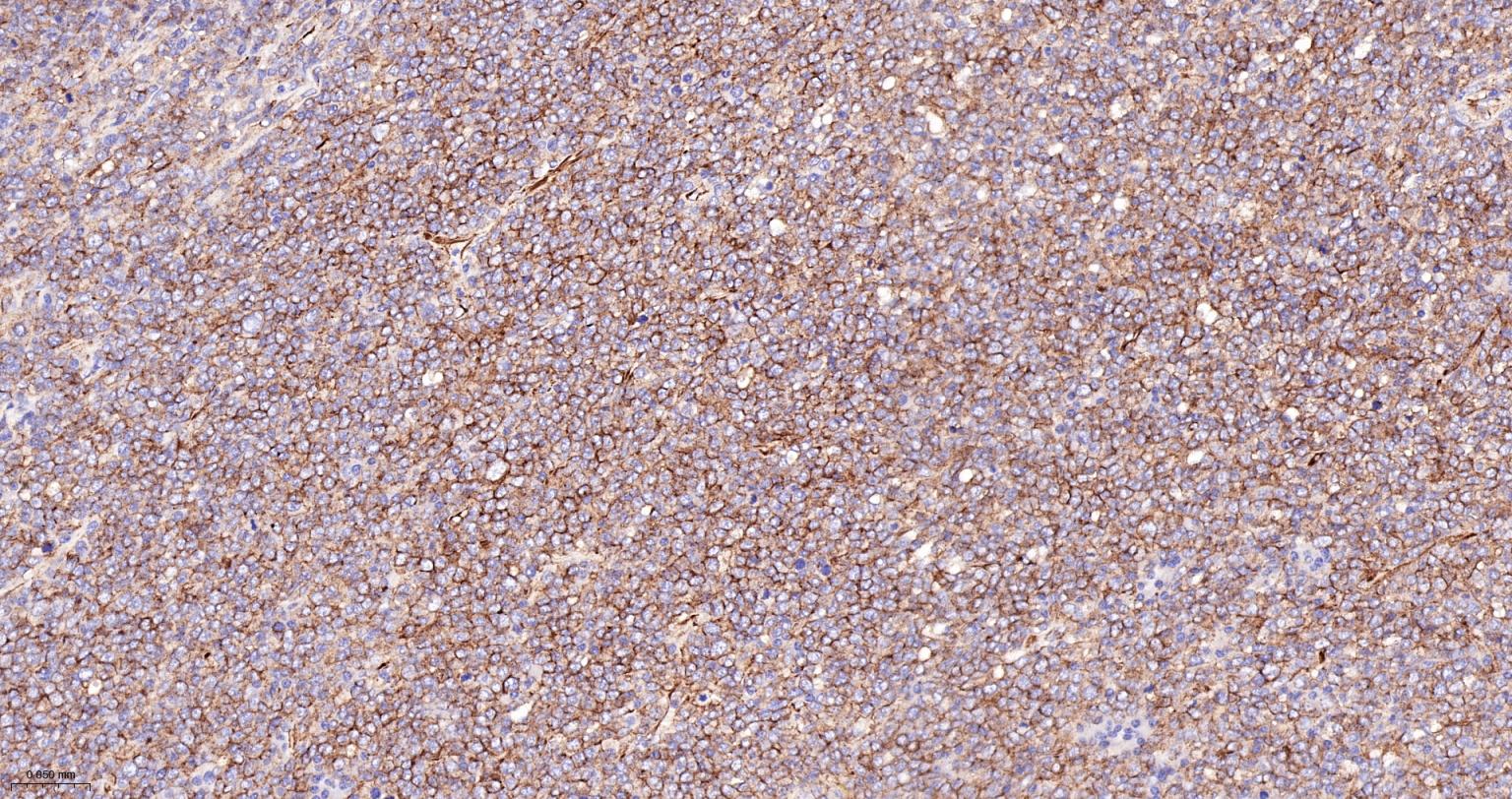 CD84重组兔单抗-bsm-62503R