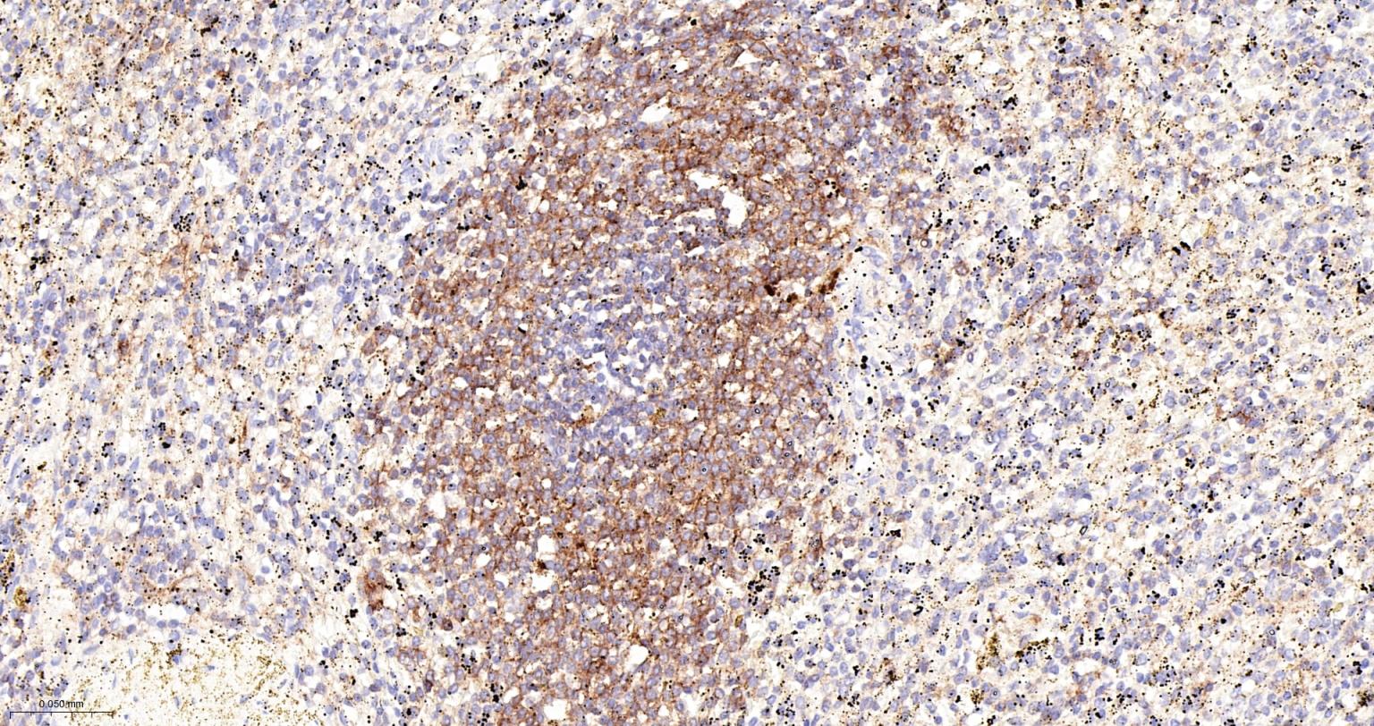 CD84重组兔单抗-bsm-62503R