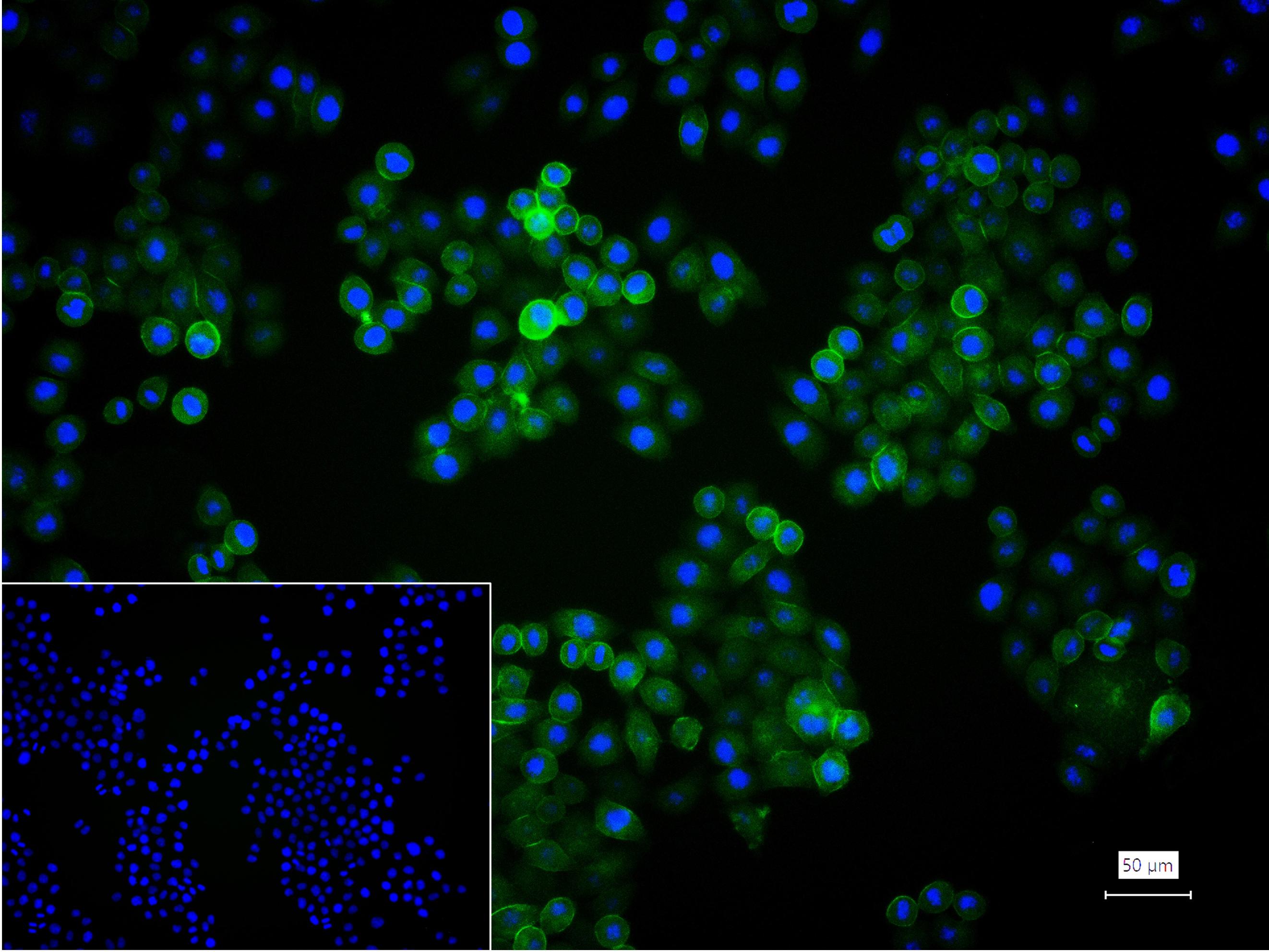 整合素α2（CD49b）重组兔单抗-bsm-52613R
