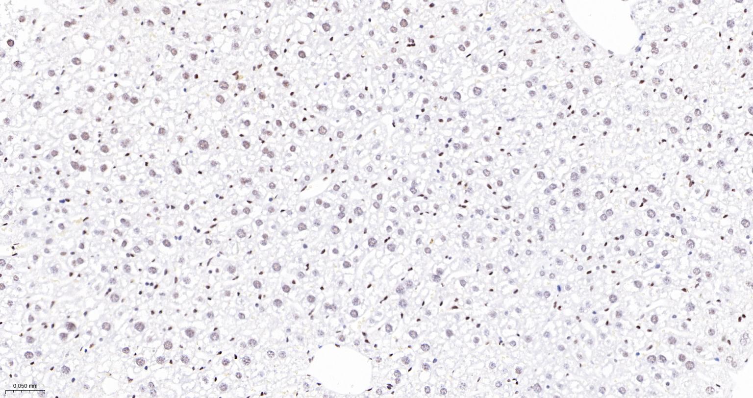 染色体结构维持蛋白质１α重组兔单抗-bsm-62981R