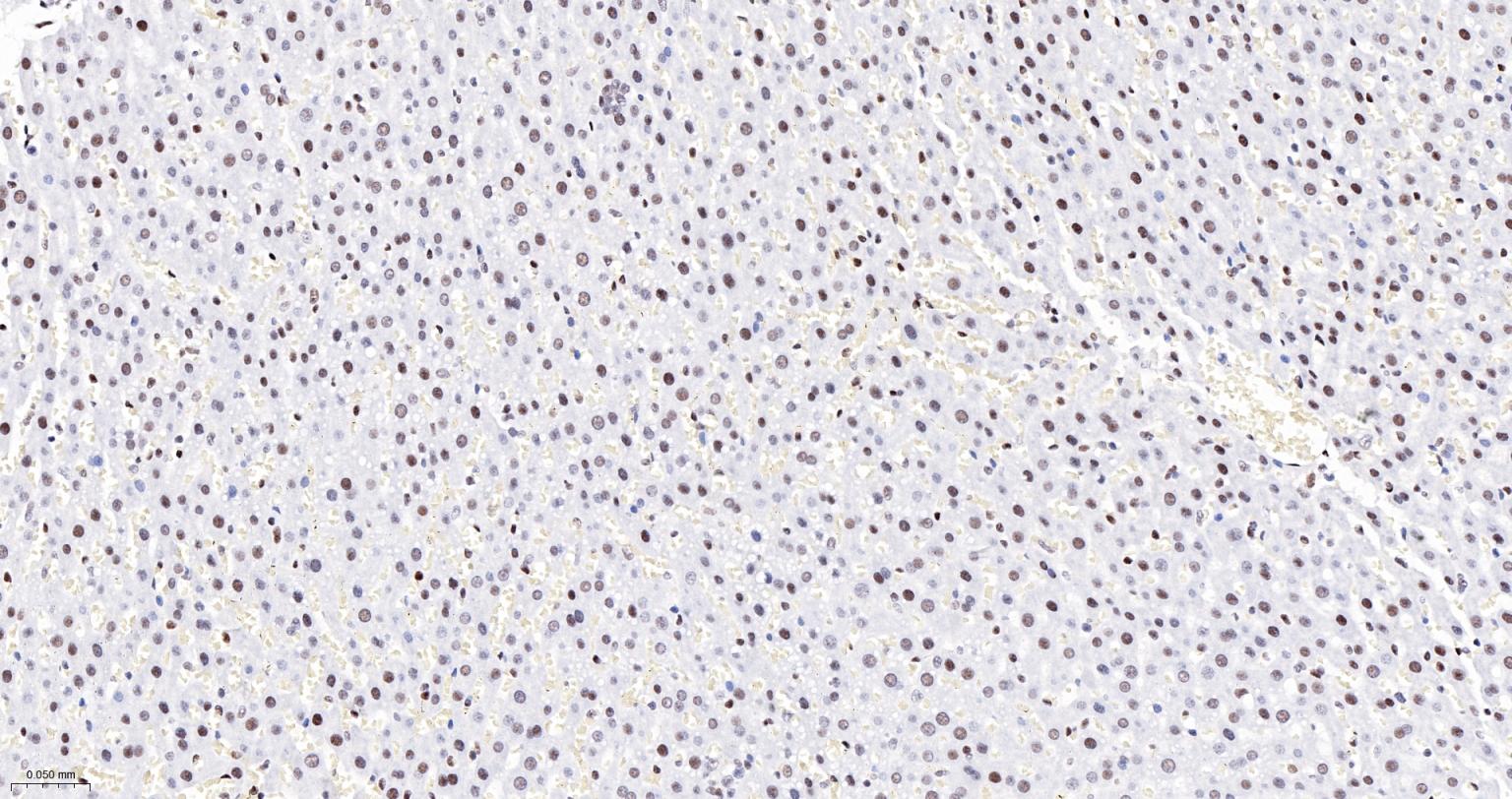 染色体结构维持蛋白质１α重组兔单抗-bsm-62981R