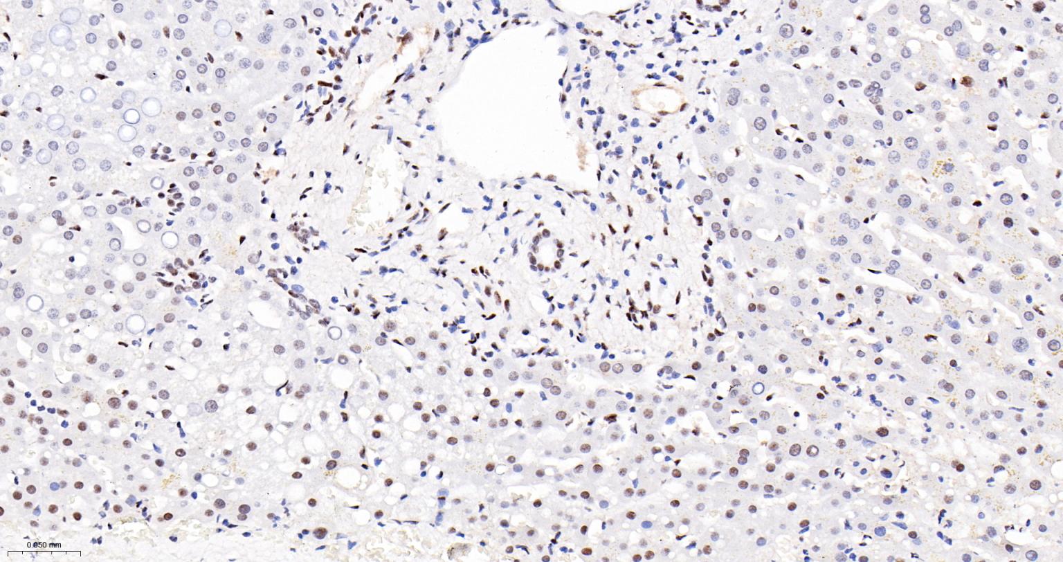染色体结构维持蛋白质１α重组兔单抗-bsm-62981R