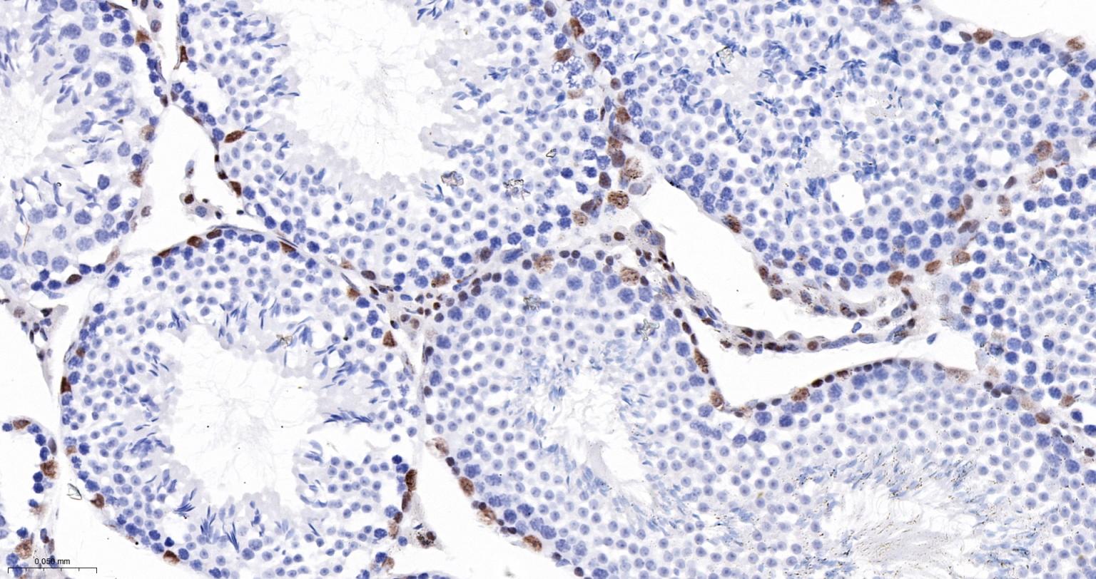 染色体结构维持蛋白质１α重组兔单抗-bsm-62981R