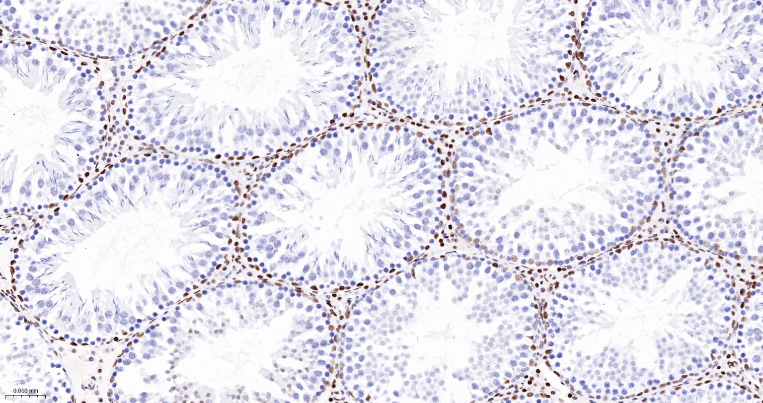 染色体结构维持蛋白质１α重组兔单抗-bsm-62981R