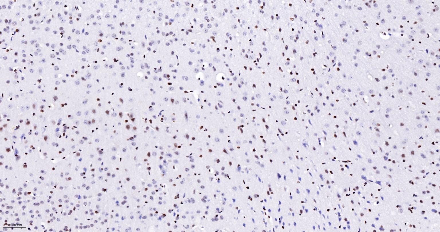 染色体结构维持蛋白质１α重组兔单抗-bsm-62981R