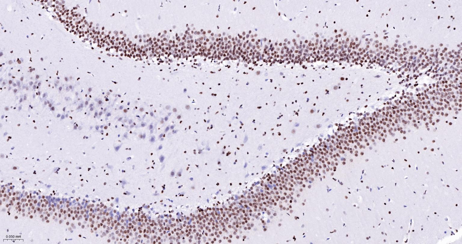 染色体结构维持蛋白质１α重组兔单抗-bsm-62981R