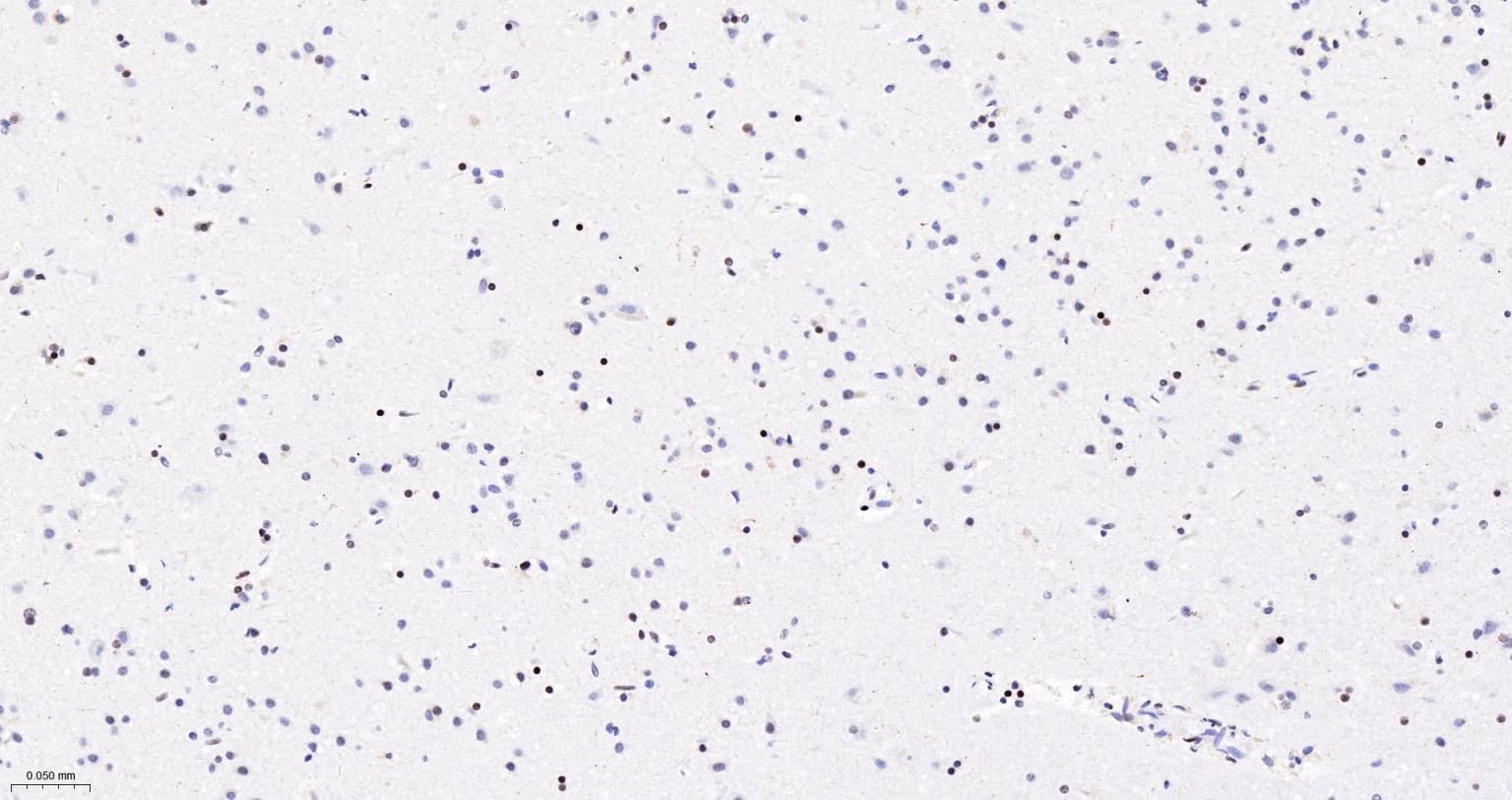 染色体结构维持蛋白质１α重组兔单抗-bsm-62981R