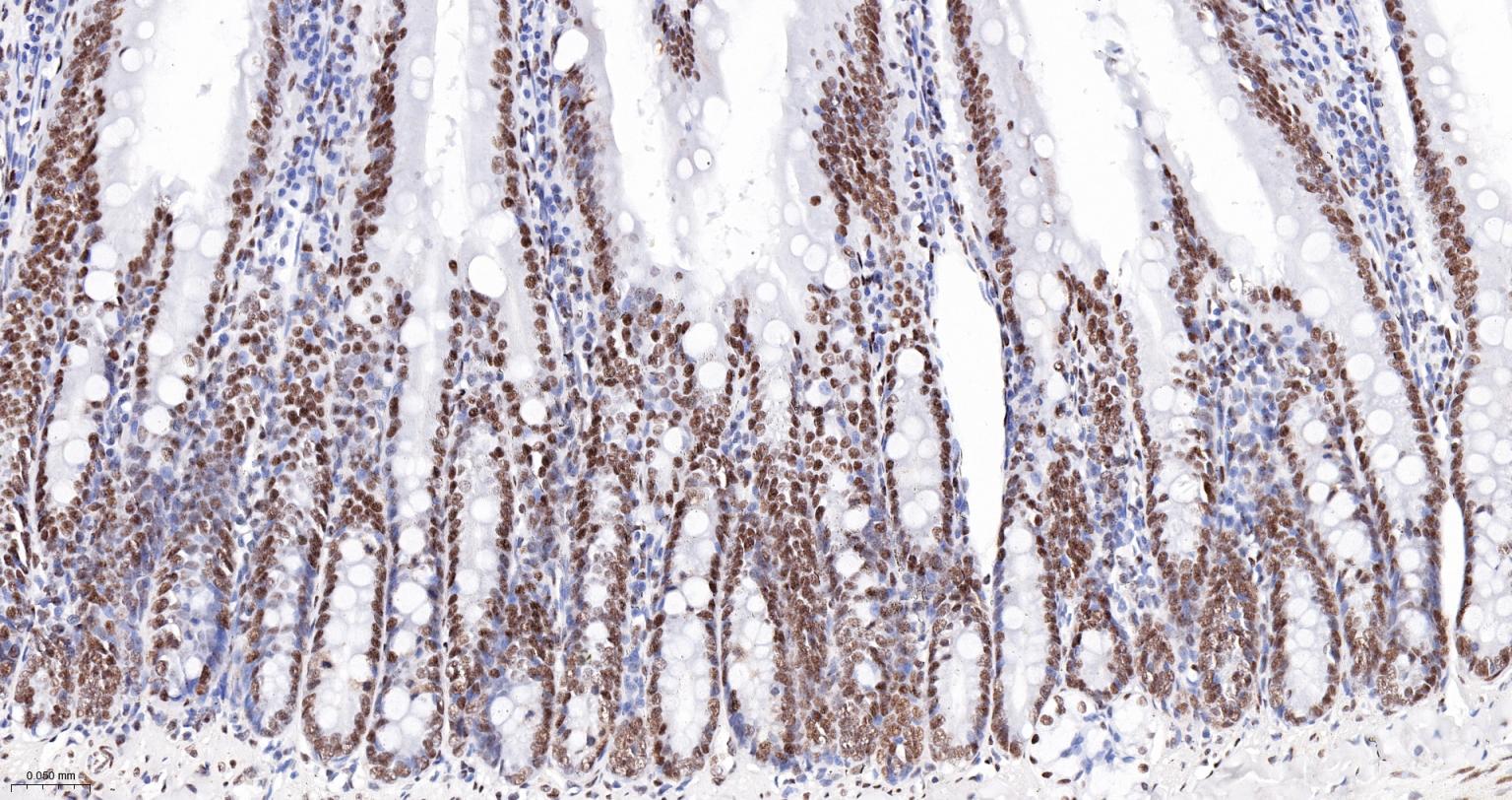 染色体结构维持蛋白质１α重组兔单抗-bsm-62981R