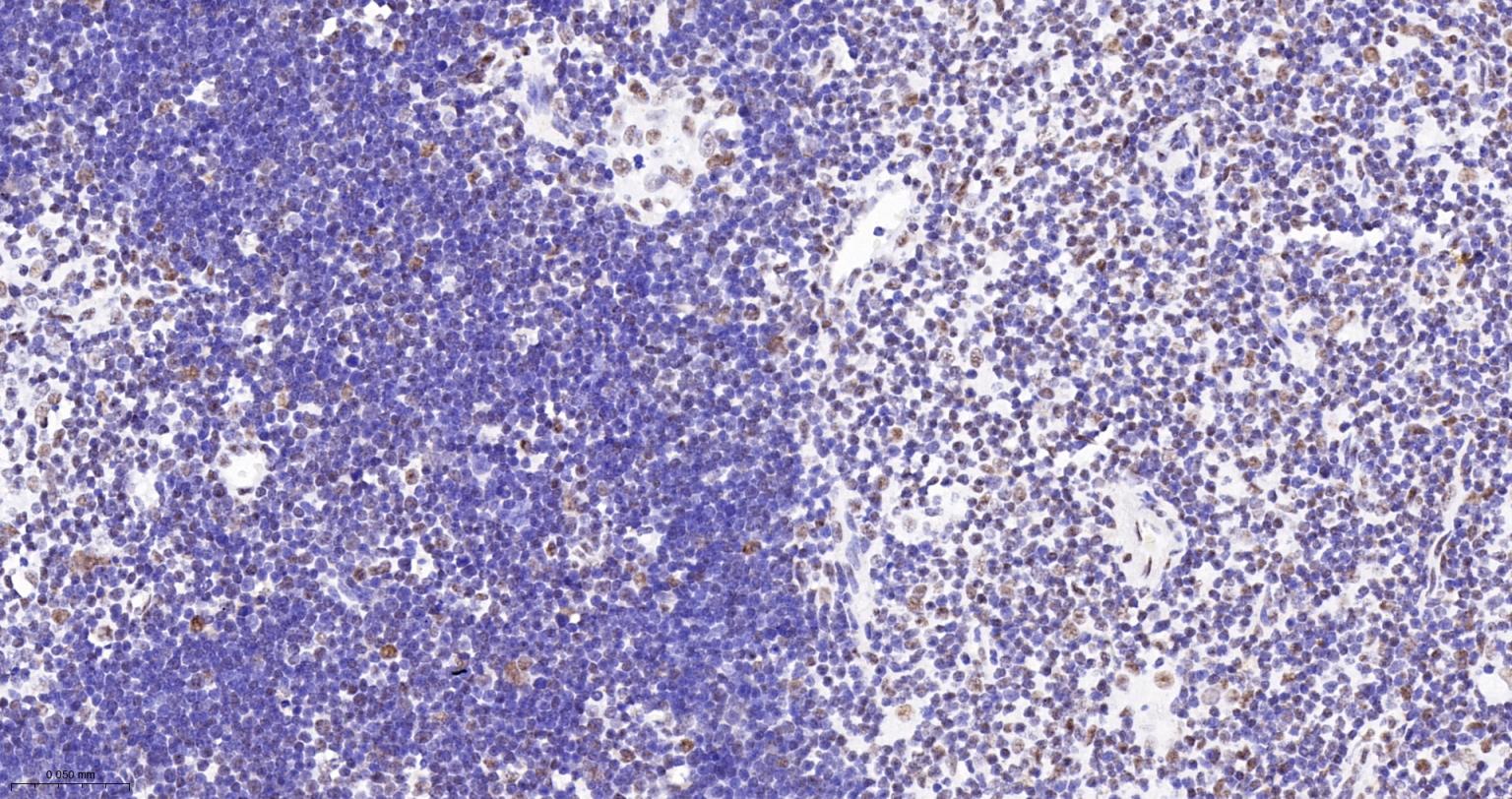染色体结构维持蛋白质１α重组兔单抗-bsm-62981R