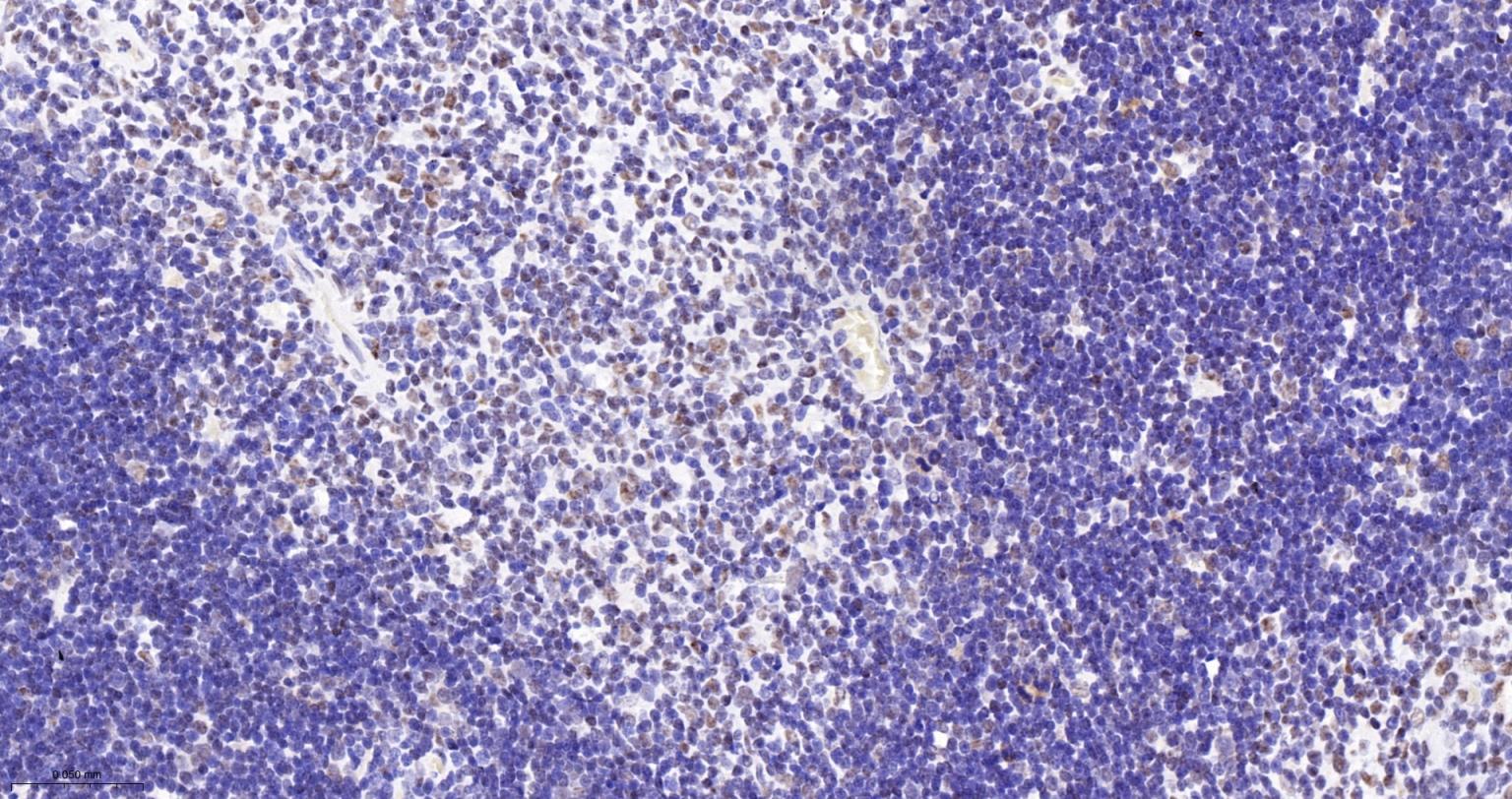 染色体结构维持蛋白质１α重组兔单抗-bsm-62981R