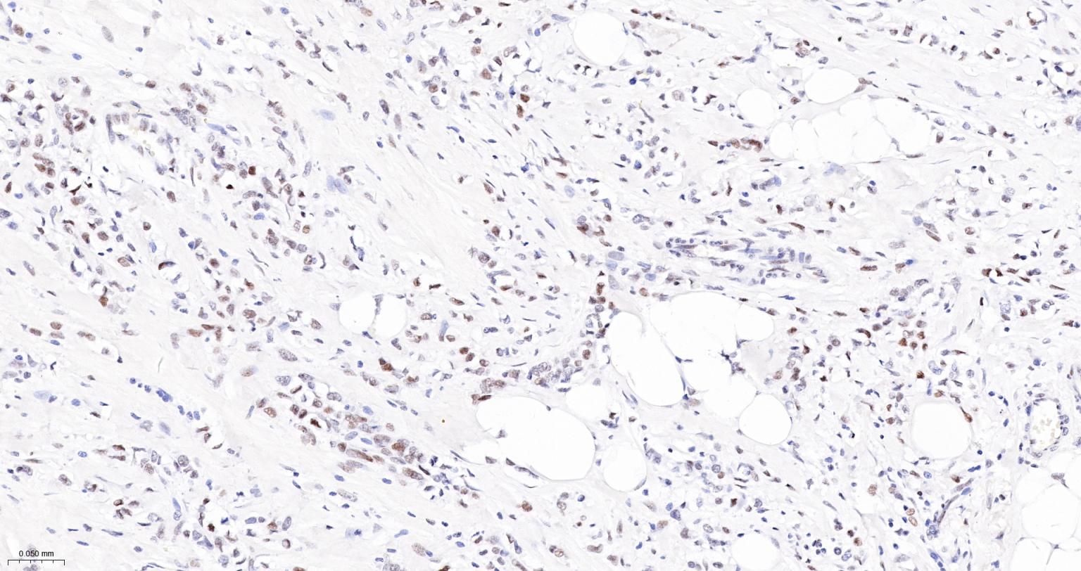 染色体结构维持蛋白质１α重组兔单抗-bsm-62981R