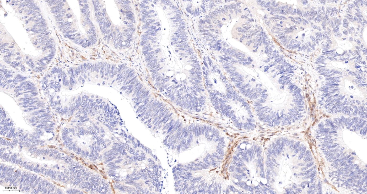 一种肿瘤抑制基因抗体-bsm-52369R