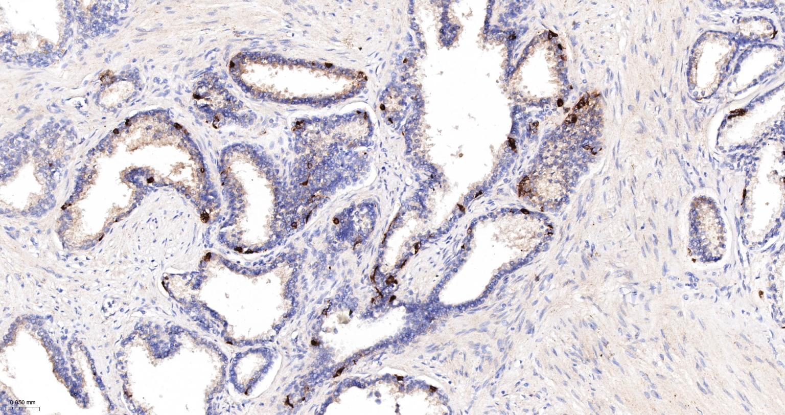 一种肿瘤抑制基因抗体-bsm-52369R