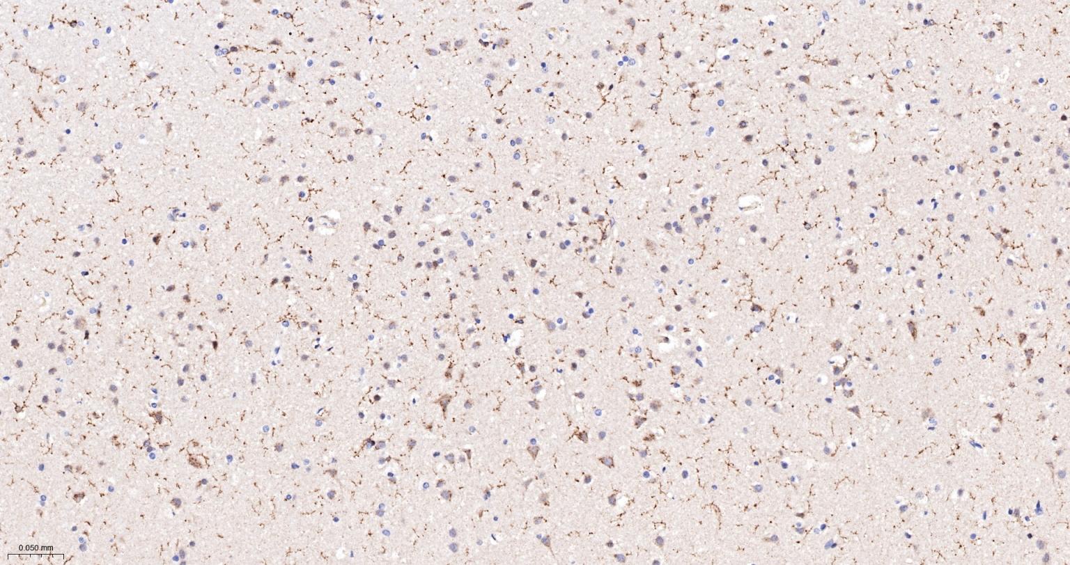 一种肿瘤抑制基因抗体-bsm-52369R