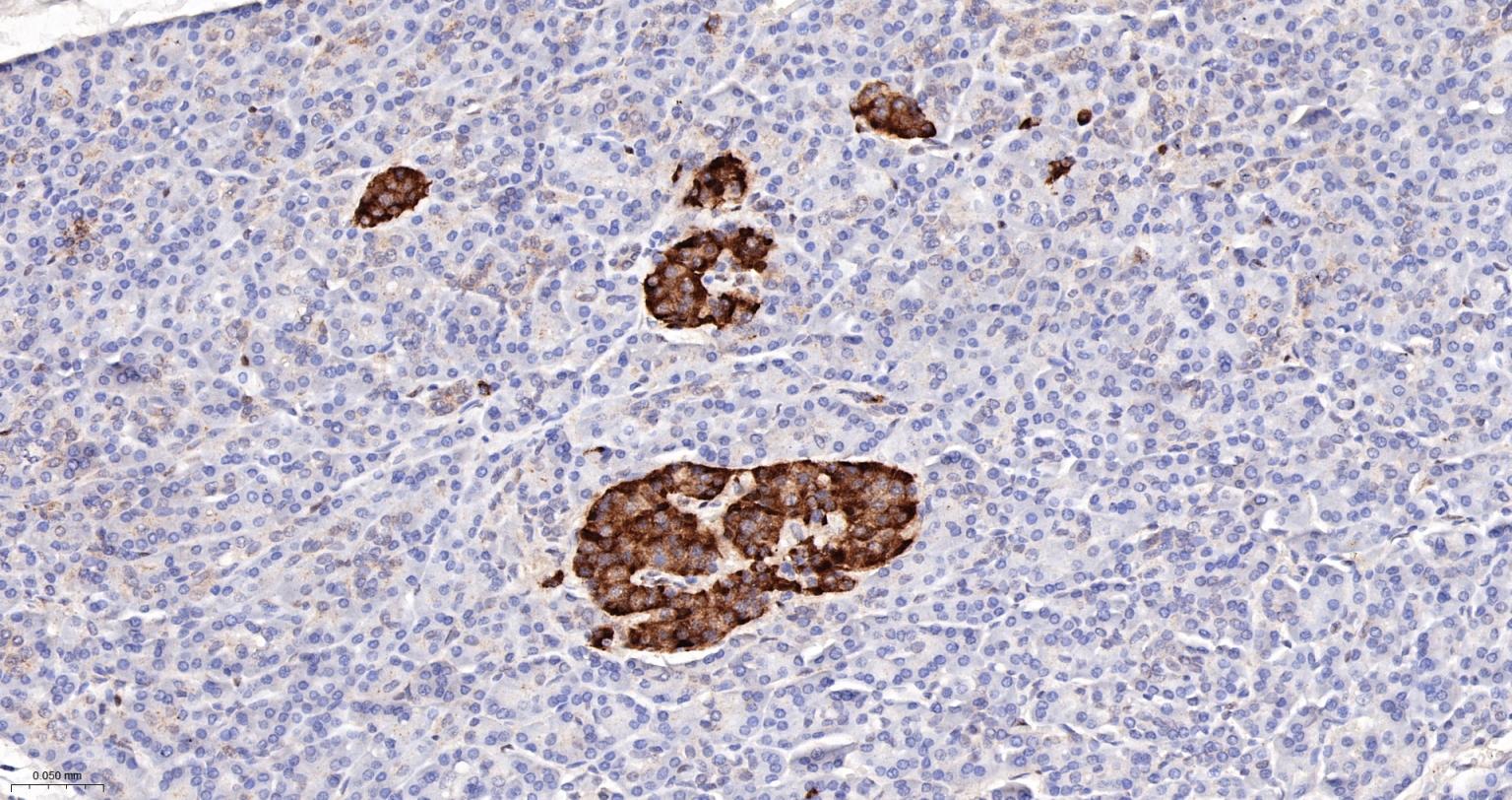 一种肿瘤抑制基因抗体-bsm-52369R