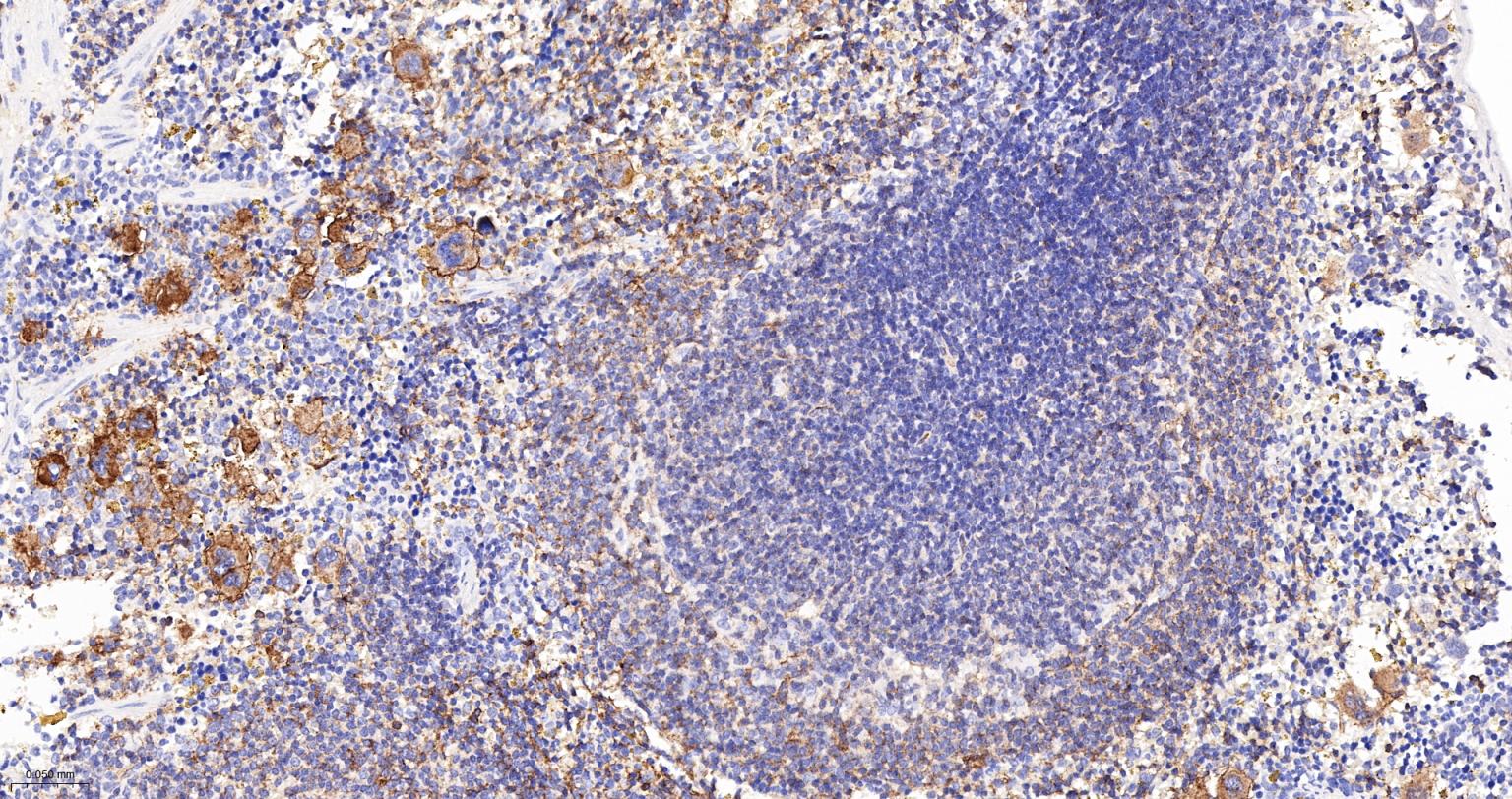 整合素α2（CD49b）重组兔单抗-bsm-52613R