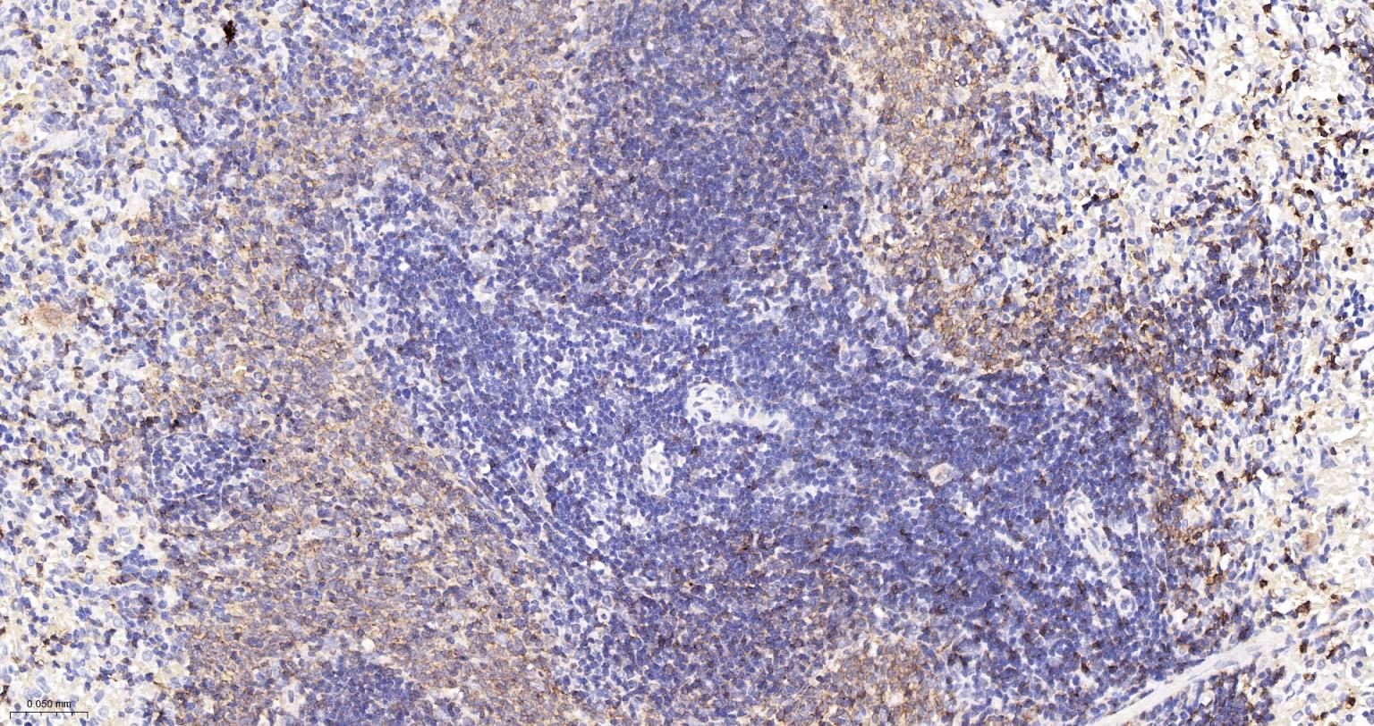整合素α2（CD49b）重组兔单抗-bsm-52613R