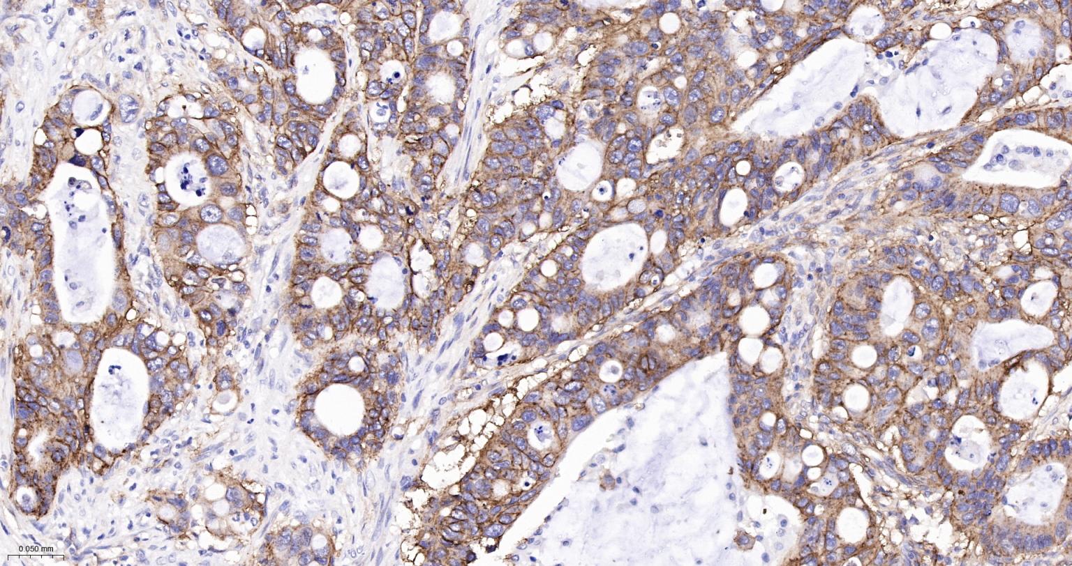 整合素α2（CD49b）重组兔单抗-bsm-52613R