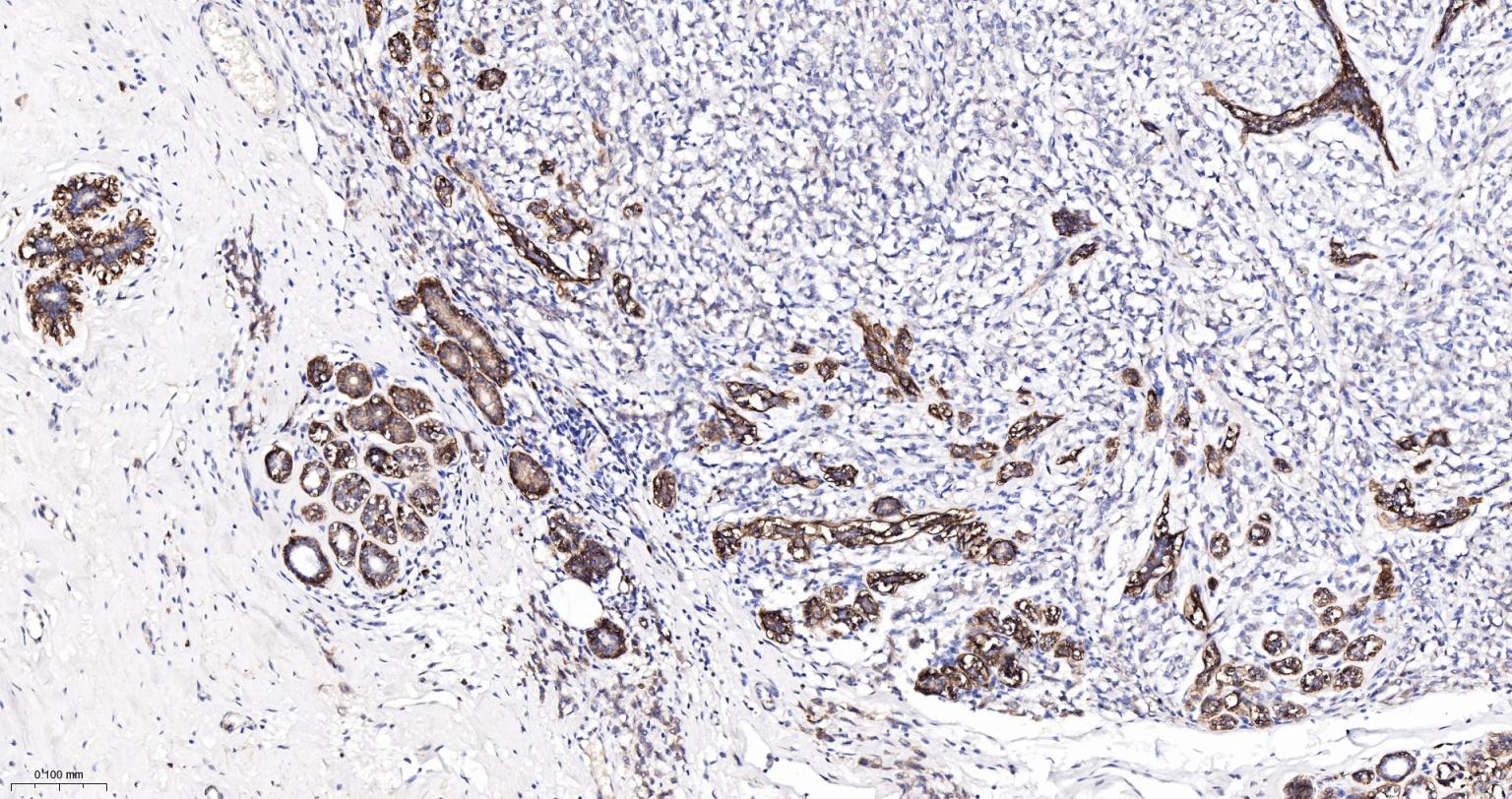 整合素α2（CD49b）重组兔单抗-bsm-52613R