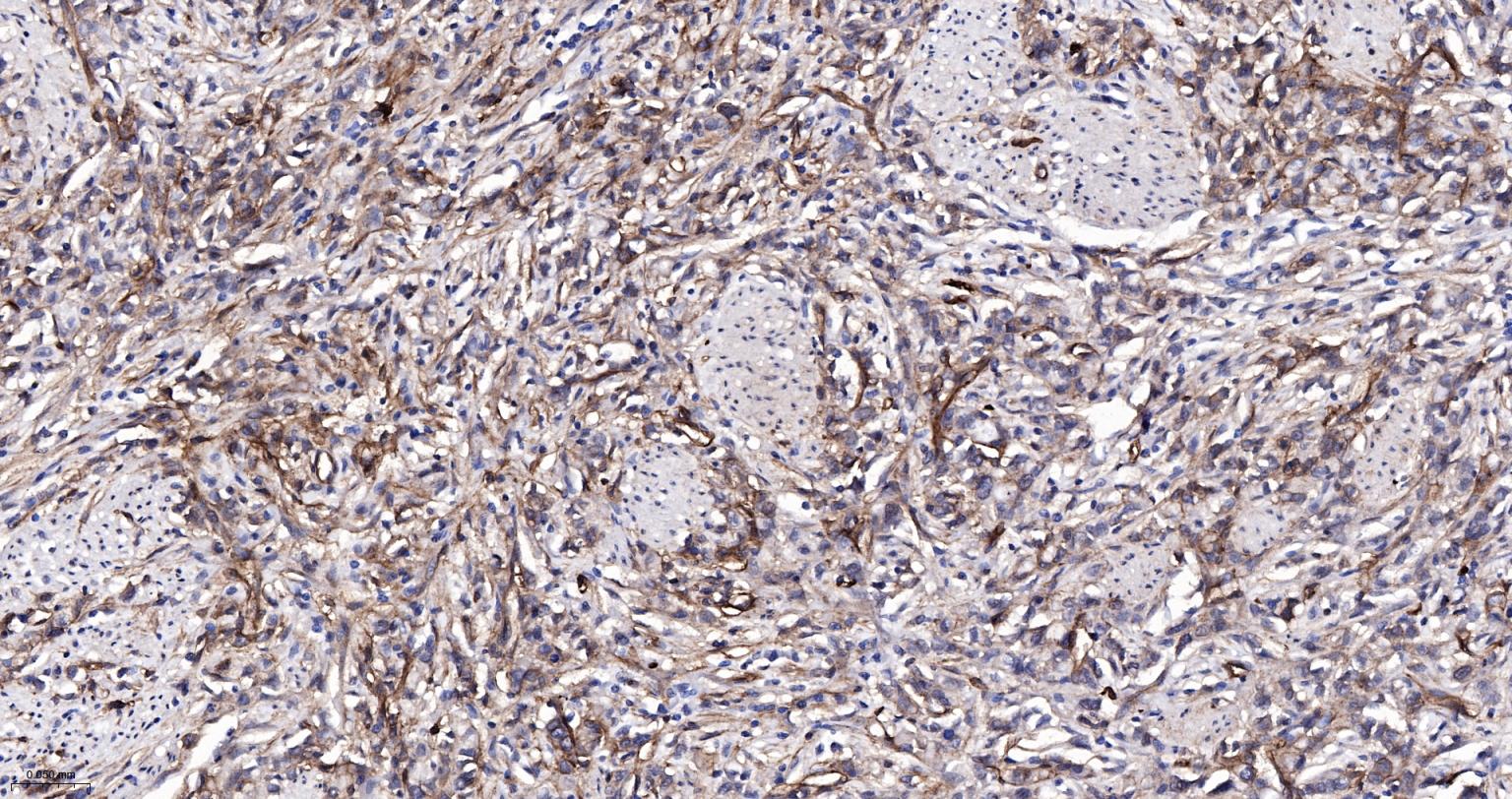 整合素α2（CD49b）重组兔单抗-bsm-52613R