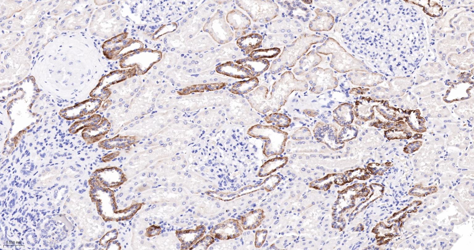 水通道蛋白4重组兔单抗-bsm-61035R