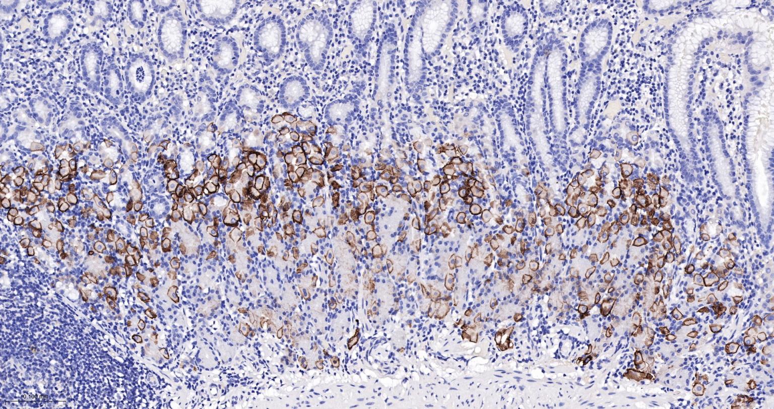 水通道蛋白4重组兔单抗-bsm-61035R